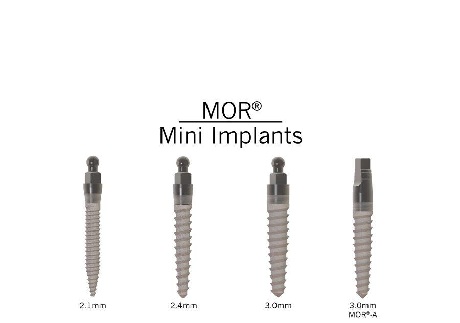 Increased Practice Growth And Patient Satisfaction With The MOR® Mini Dental Implant System