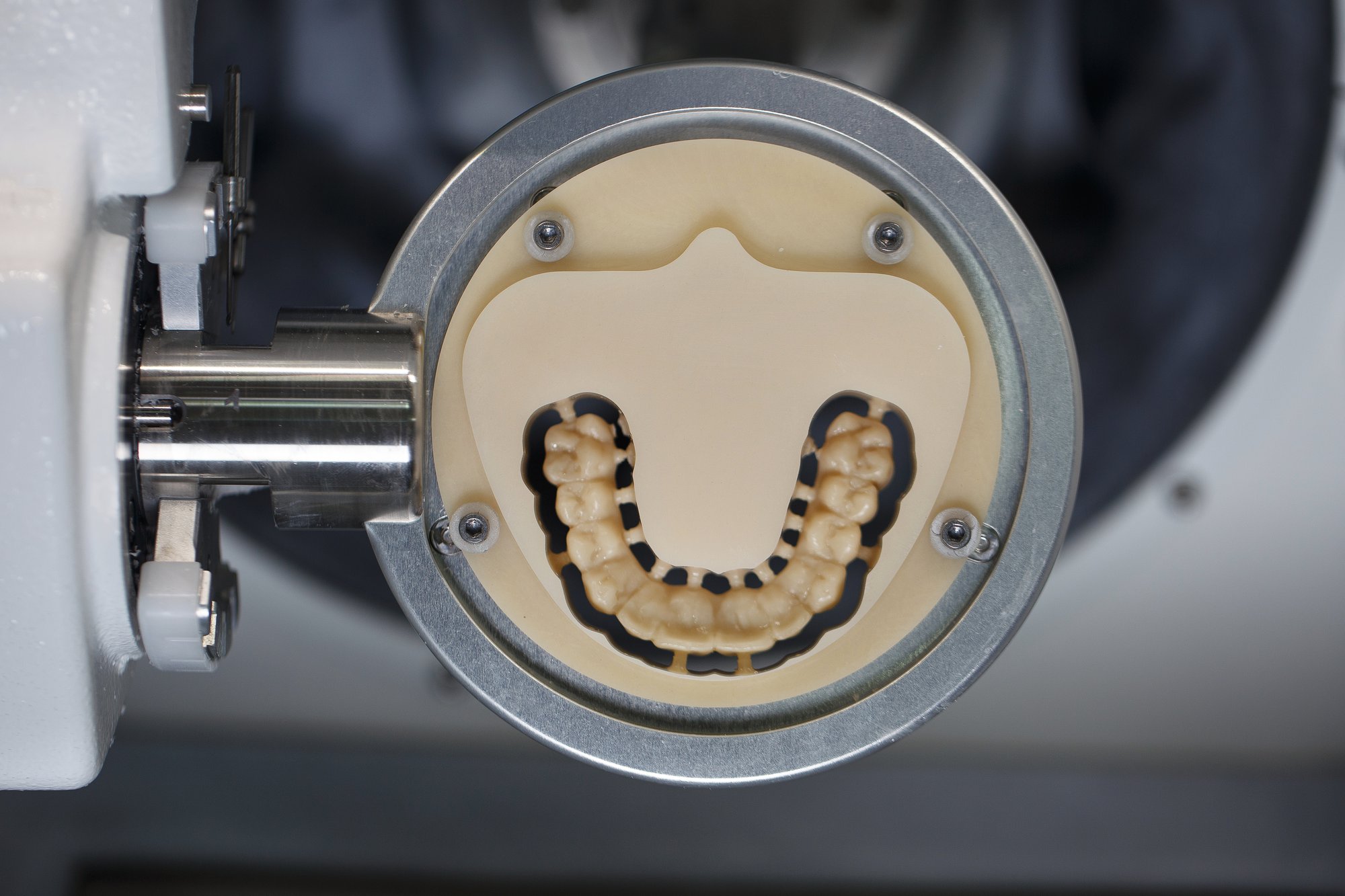 Digital Dentures: The Future of Denture Technology