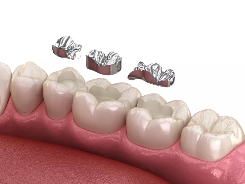 restorative dentistry
Source: Shutterstock